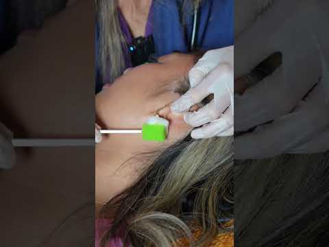 Asmr ear 👂 exam #asmr #relax #relaxing #asmrsounds #asmrvideo #tingles #medical #satisfying #sleep