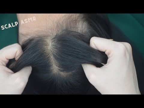 ASMR Head Scratching Real Person With Hair Parting, Hair Sounds No Talking For Reduce Headache