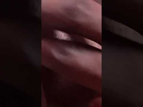 Asmr leg Nitpicking with bubblegum #asmr #tingling #nitpicking #satisfying