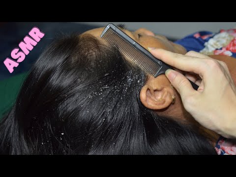 ASMR Scalp Check ~ Scalp Scratching ~ Scalp Massage ~ Dandruff Scratching ~ Hair Scratch Relaxing ~~