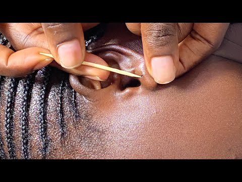 ASMR EAR- PIERCING CLEANING AND NITPICKING FOR RELAXATION-Bubblegum
