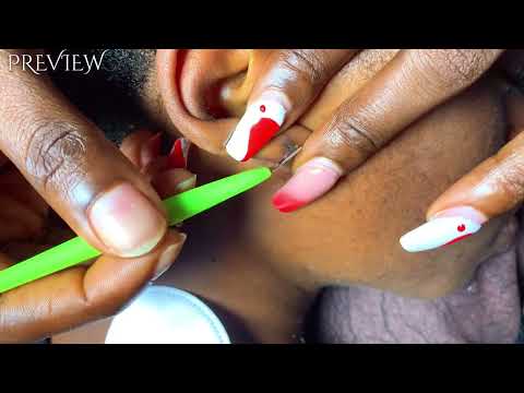 Asmr ear cleaning with earbuds asmr, for sleep tingles and relaxation 