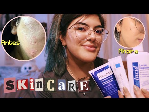 ASMR así eliminé el acné de mi cara ✨ mi rutina de skincare + recomendaciones