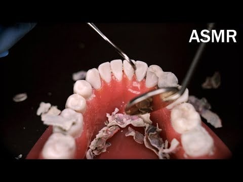 それっぽい器具💉で治療する歯科医ロールプレイ🦷ASMR [字幕, ピアス]