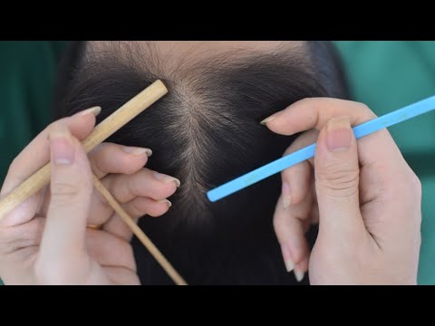 ASMR Scalp Scratching Massage, Head Scratching Tingles, Therapy Sounds For Stress Relief