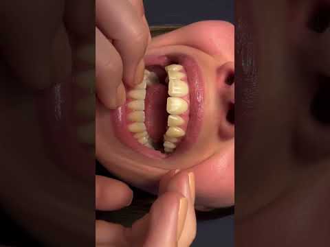 Pov: Vc elogiou meu sorriso mas eu faço ASMR #asmr #tapping