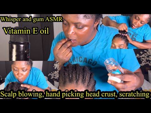 ASMR ✨Soft whisper Gum, Vitamin E oil, scalp blowing, hair crust picking, scalp scratching