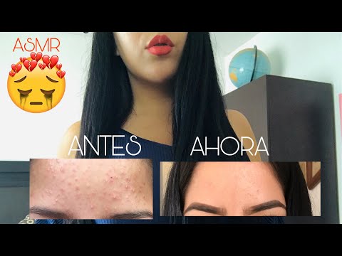 ASMR MI EXPERIENCIA CON EL ACNÉ🥺