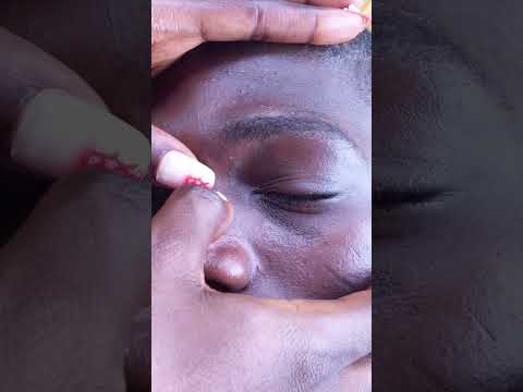 Tingling triggers #satisfying #asmr  #nitpicking #relaxing