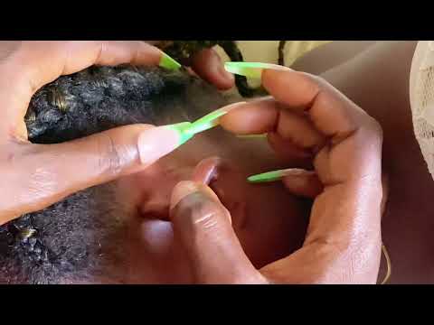 Asmr A Rare Ear Hole Nitpicking- Whispers