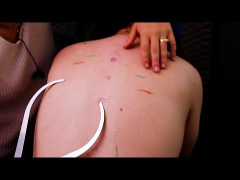 ASMR Holistic Back Mapping & Stimulation Treatment (Weird but Effective)