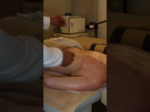 Acupuntura en espalda #spa #massage #masaje #relaxing #short #caracs