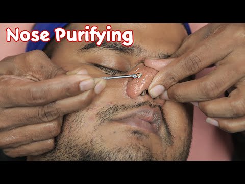 ASMR Satisfying Blackheads Extracted | Face Purifying Treatment ASMR | Head Massage With 3d Sounds