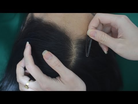 ASMR Head Scratch, Hair Parting On Real Person / Scratching Sounds, Therapy For Relaxation