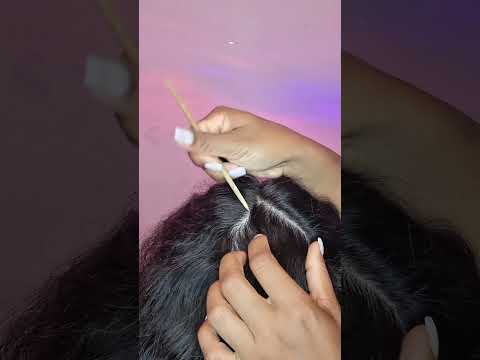 ASMR - TIRANDO CASPA DO SEU CABELO (APLICADO) #asmr #shorts #shortvideo