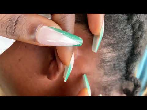 Ear picking cleaning Asmr: on a real person - Bubble gum