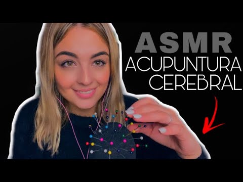 ASMR Acupuntura CEREBRAL para ayudarte a DORMIR 😴 | Asmr Español