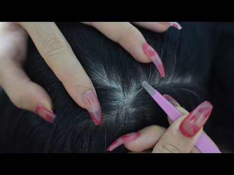 ASMR Scalp Check, Scalp Picking, Hair Plucking For Relieve Stress, Headache, Anxiety