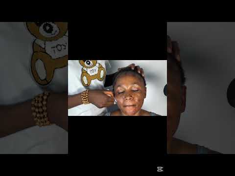 ASMR FACE NITPICKING AND CLEANING, PIMPLE POPPING FOR SLEEP VERY SATISFYING