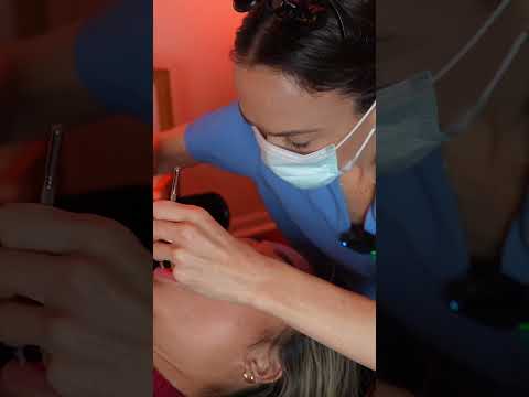 Asmr dental #asmr #asmrsounds #asmrvideo #relaxing #relax #satisfying #satisfyingvideo #tingles
