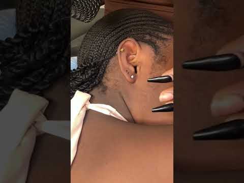 ASMR EAR CLEANING,HEAD SCRATCHING,BACK SCRATCHING & NITPICKING FOR SLEEP
