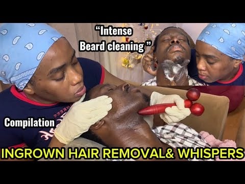 ASMR Satisfying Beard Nitpicking,Neck Massage,Ingrownhair pull out,Intense foam tingles compilation 