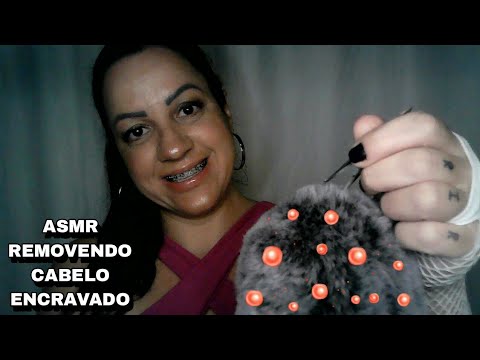 ASMR-REMOVENDO CABELO ENCRAVADO #asmr #rumo3k #asmrportuguês #sonsdeboca