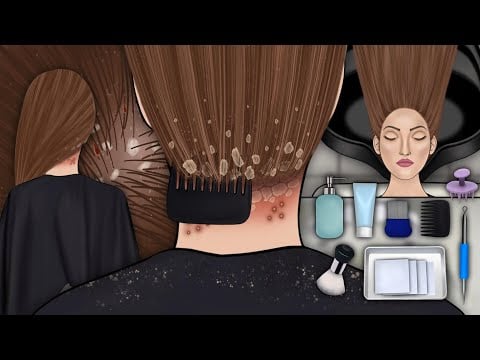 Head lice and Dandruff removal || Scalp treatment animation || ASMR animation ||