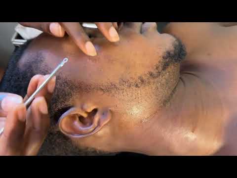 ASMR FACE NITPICKING AND BEARDS PICKING FOR THOSE WHO NEED QUICK SLEEP VERY SATISFYING WITH GUM
