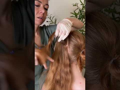 Asmr scalp tingles #asmr #asmrsounds #asmrvideo #relax #relaxing #satisfying #hair #sleep #tingles