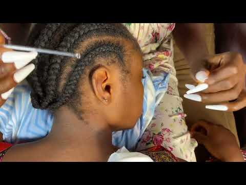 ASMR EAR SCRATCHING, NECK SCRATCHING, BACK SCRATCHING, SCALP SCRATCHING FOR SLEEP NO GUM CHEWING|