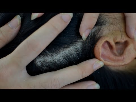 ASMR Scalp Check ~ Scalp Scratching ~ Scalp Cleansing ~ Ear Check ~ Zoom x10