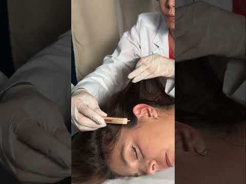 Asmr scalp tingles #asmr #asmrsounds #asmrvideo #relax #relaxing #satisfying #hair #sleep #tingles