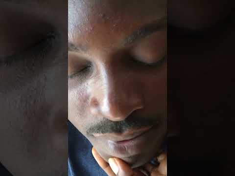 Nitpicking The Beards and Mustache cleaning #satisfying #asmrscratching #nitpicking