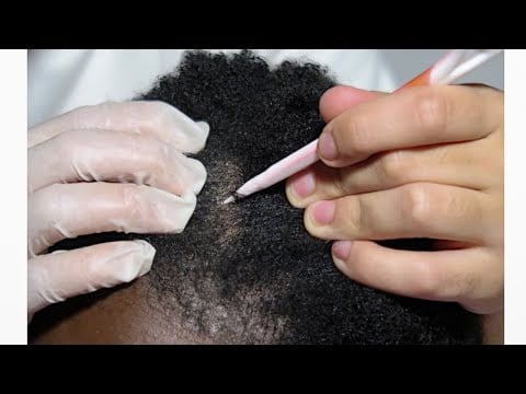 {ASMR} Sleep Inducing Hair Scratch | Examination