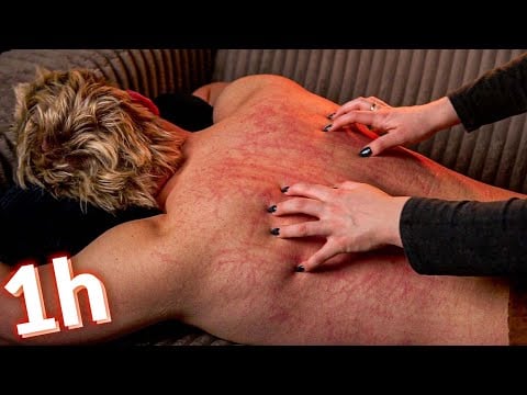 Aggressive Back & Scalp ASMR 💥 Fast Scratching & Deep Scalp Triggers (No Talking)