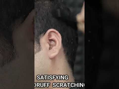 Satisfying Dandruff Treatment ASMR #shorts