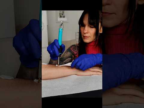 Nerve regeneration on the arm