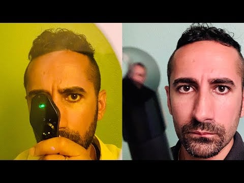 ASMR: Two Skilled ASMR Eye Professionals Treat You (role play)