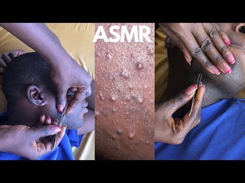 Asmr getting something out of your face #asmr #relaxation  #satisfying