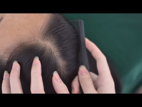 ASMR Scalp Scratching No Talking, Tingles Head Scratching Massage For Relaxation
