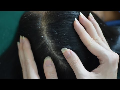 ASMR Scalp Scratching Fast And Aggressive For Relieve Stress, Headache, Anxiety ( No Talking )