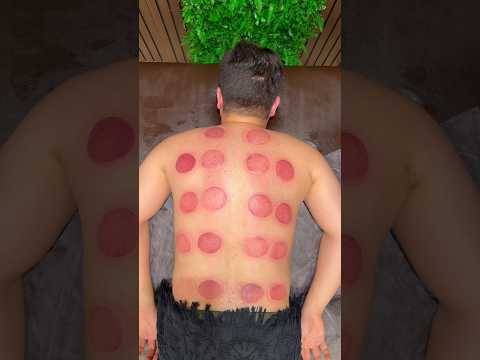 wow pizza cupping😍🍕#pizza #cupping #asmr #relxing #shorts #cuppingtherapy #fire #massage
