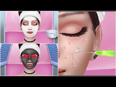 Acne treatment ASMR | Animated needle acne treatment
