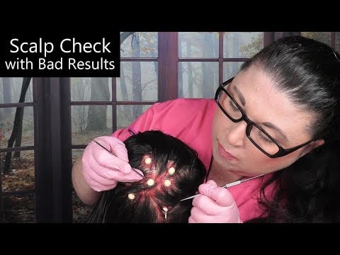 ASMR Scalp Check with Bad Results (Acne Removal, Scalp Treatment, Whispering) Medical Roleplay