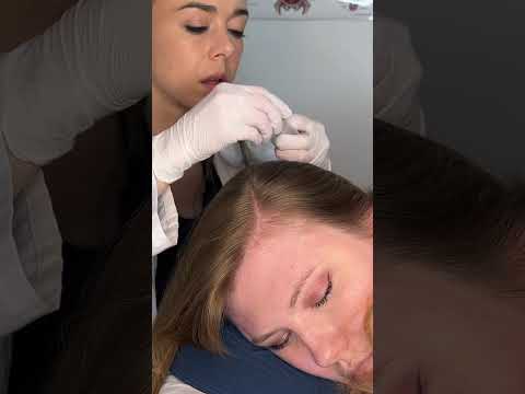Asmr scalp 💆🏻‍♀️ #asmr #asmrsounds #asmrvideo #relax #relaxing #satisfying #hair #sleep #tingles