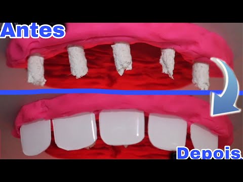 ASMR: COLOCANDO LENTE DE CONTATO NOS DENTES 🦷 (dentista roleplay) -  vem relaxar aqui