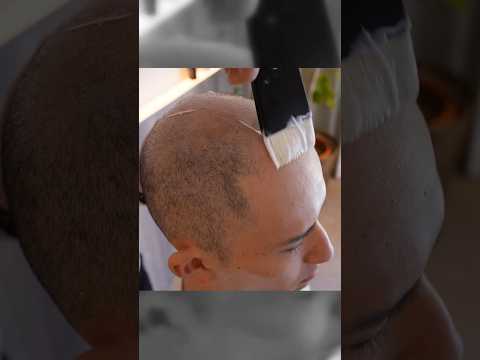 Head massage to improve blood circulation in the scalp #massagetherapy #asmr #relaxing