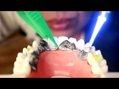 💤 asmr dentiste ultra doux pour s'endormir