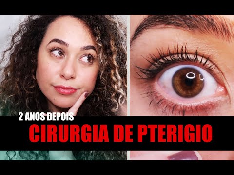 Como está meu olho depois de 2 anos de cirurgia de pterígio? | Perguntas e Respostas